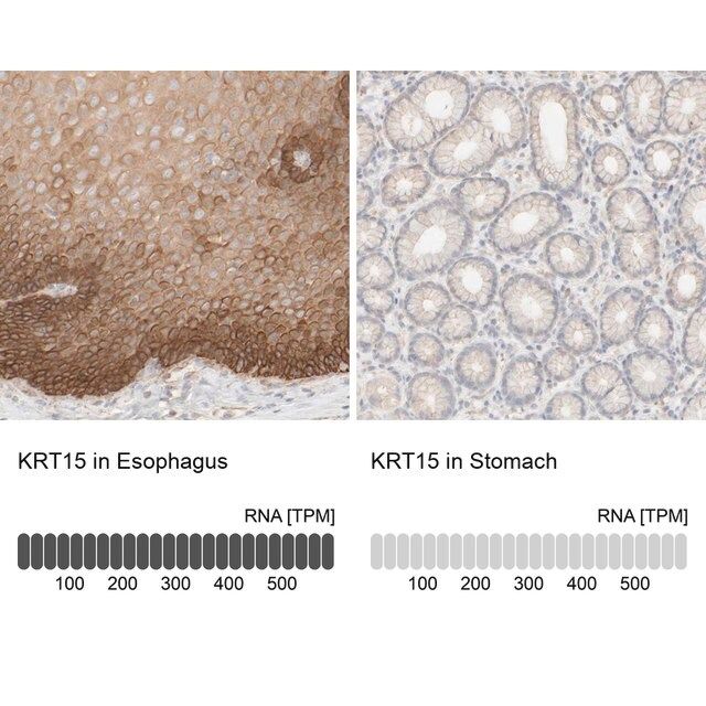 Anti-KRT15 antibody produced in rabbit