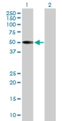 Anti-KRT36 antibody produced in mouse