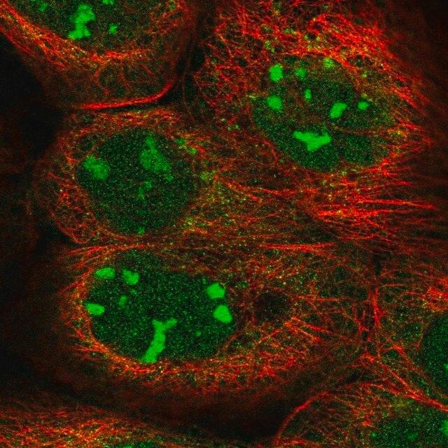 Anti-KRR1 antibody produced in rabbit