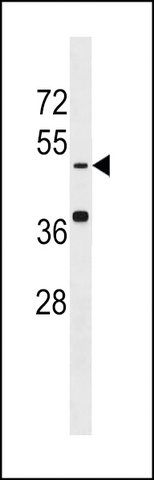 ANTI-KREMEN(N-TERMINAL) antibody produced in rabbit