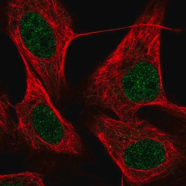 Anti-KRBOX4 antibody produced in rabbit