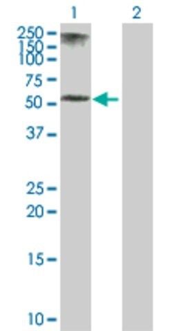 Anti-KRT5 antibody produced in rabbit