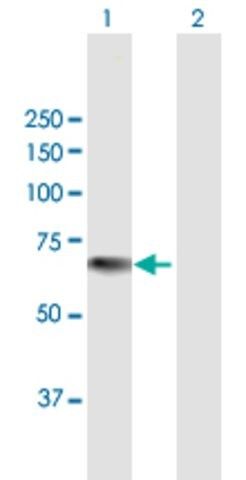 Anti-KRT76 antibody produced in mouse