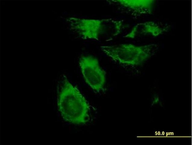 Anti-KRT7 antibody produced in mouse