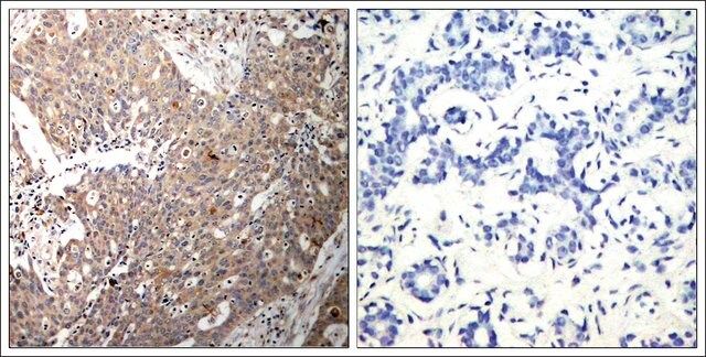 Anti-KRT18 (Ab-33) antibody produced in rabbit