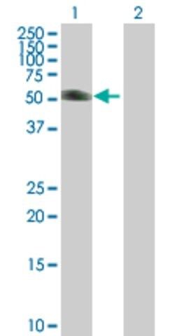 Anti-KRT20 antibody produced in mouse