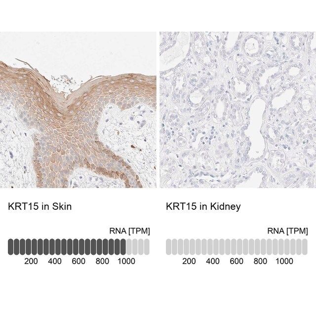 Anti-KRT15 antibody produced in rabbit