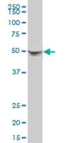 Anti-KRT8 antibody produced in mouse