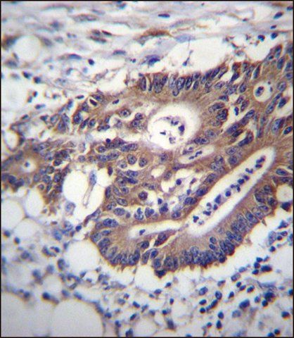 ANTI-KRT12 (C-TERM) antibody produced in rabbit