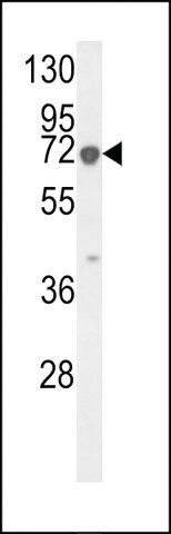 ANTI-KRT9 (CENTER K317) antibody produced in rabbit