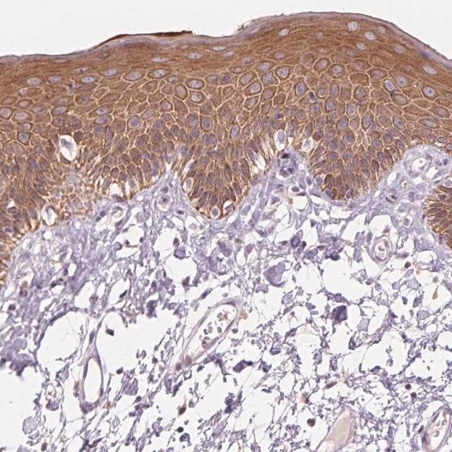 Anti-KRT1 antibody produced in rabbit