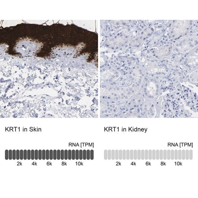 Anti-KRT1 antibody produced in rabbit