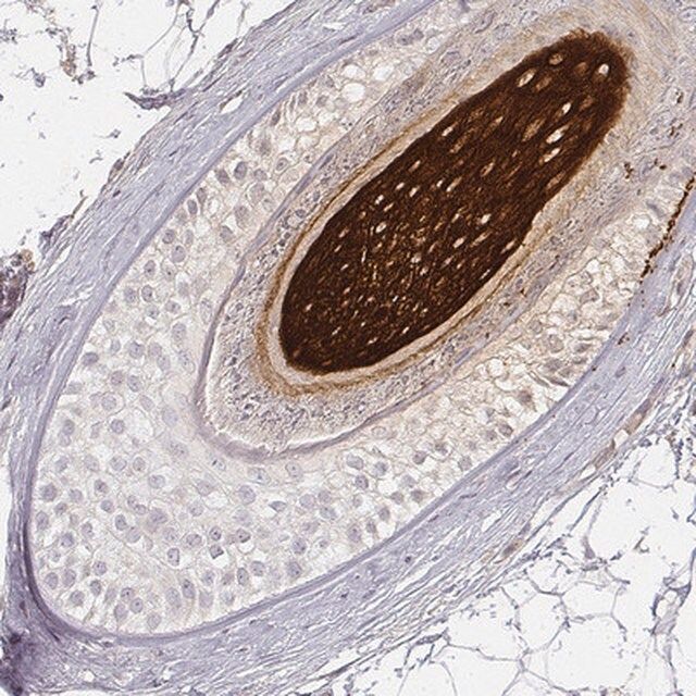 Anti-KRT31 antibody produced in rabbit