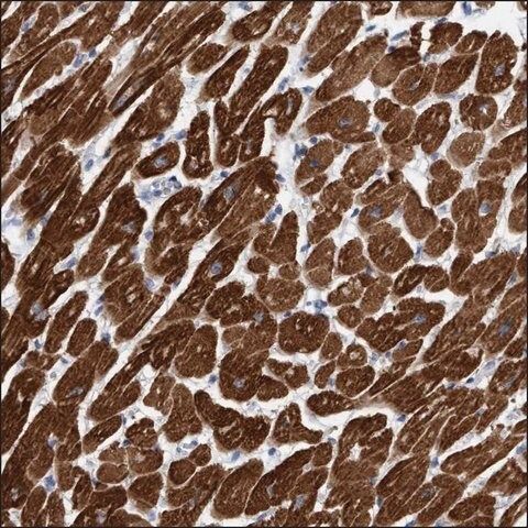 Anti-KRIT1 antibody produced in rabbit