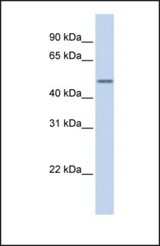 Anti-KRT16 antibody produced in rabbit