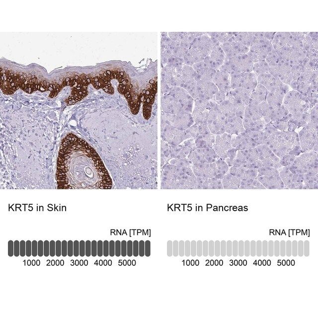 Anti-KRT5 antibody produced in rabbit