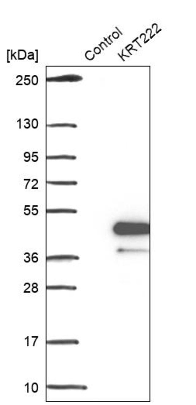 Anti-KRT222 antibody produced in rabbit