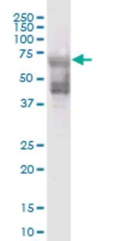 ANTI-KRT74 antibody produced in mouse