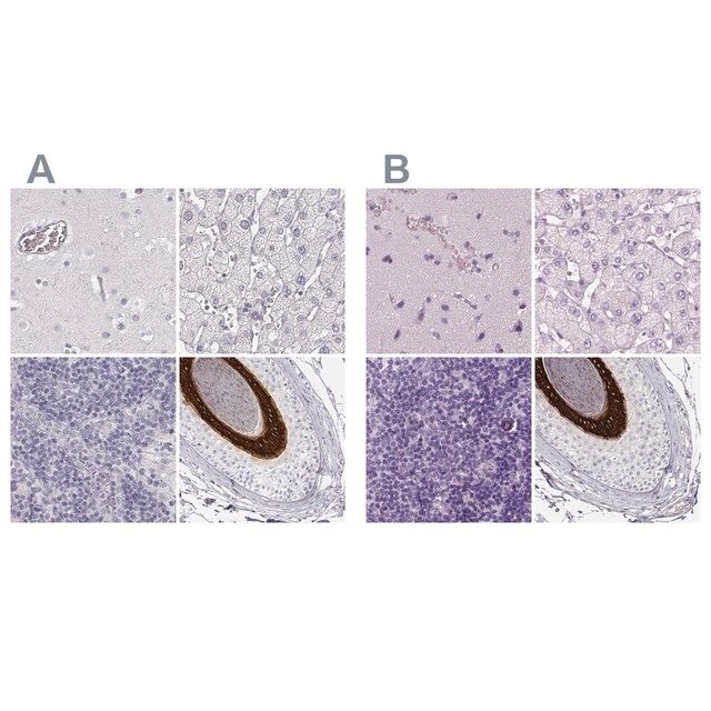 Anti-KRT25 antibody produced in rabbit