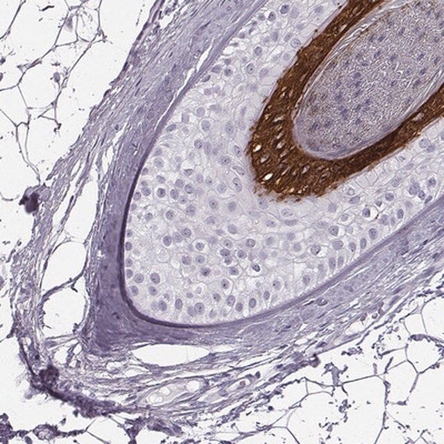 Anti-KRT74 antibody produced in rabbit