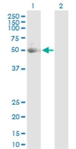 Anti-KRT7 antibody produced in rabbit