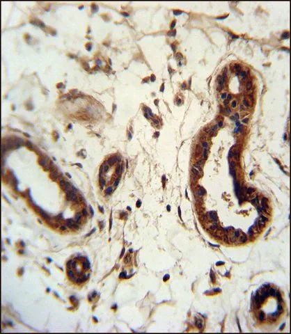 ANTI-KRT82 (CENTER) antibody produced in rabbit