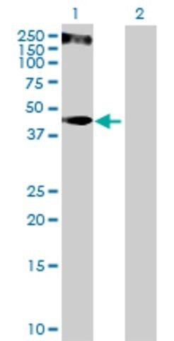 Anti-KRT34 antibody produced in mouse