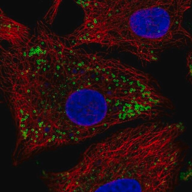 Anti-KRT222 antibody produced in rabbit