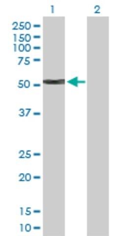 Anti-KRT4 antibody produced in rabbit