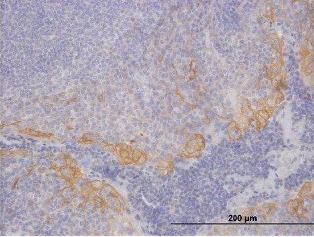 Anti-KRT19 antibody produced in mouse