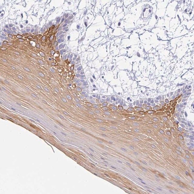 Anti-KRT4 antibody produced in rabbit