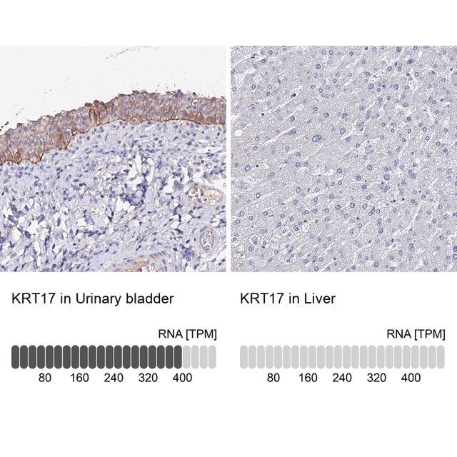 Anti-KRT17 antibody produced in rabbit