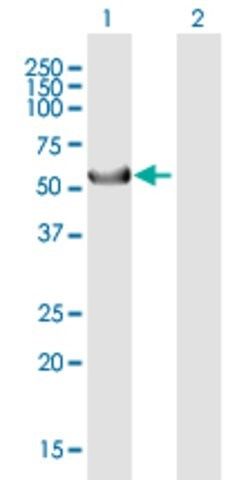 ANTI-KRT39 antibody produced in mouse