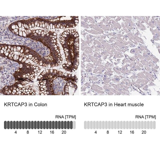 Anti-KRTCAP3 antibody produced in rabbit