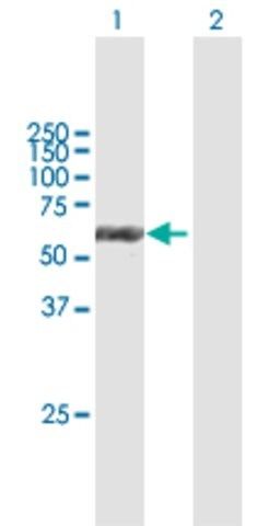 Anti-KRT6B antibody produced in mouse