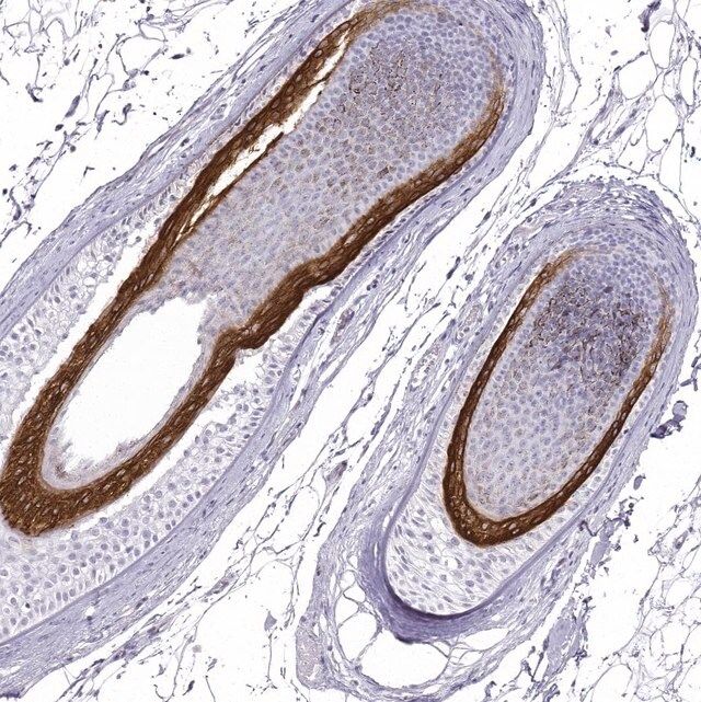 Anti-KRT71 antibody produced in rabbit