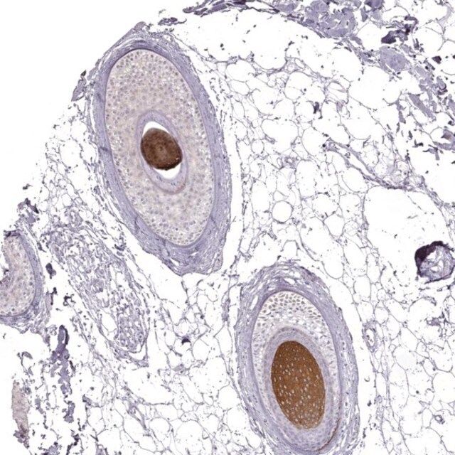 Anti-KRT31 antibody produced in rabbit