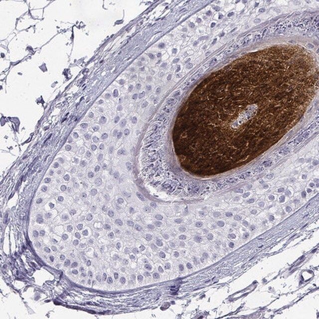 Anti-KRTAP2-4 antibody produced in rabbit