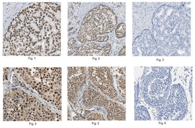 Anti-Ku70 Protein Antibody