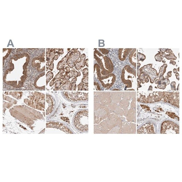 Anti-KYAT3 antibody produced in rabbit