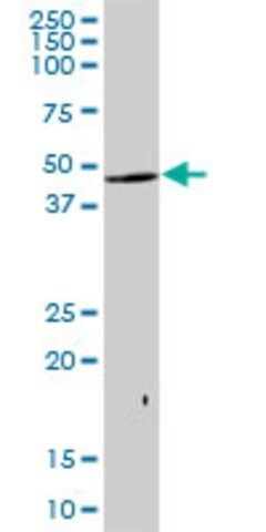 Anti-KRTHA2 antibody produced in mouse