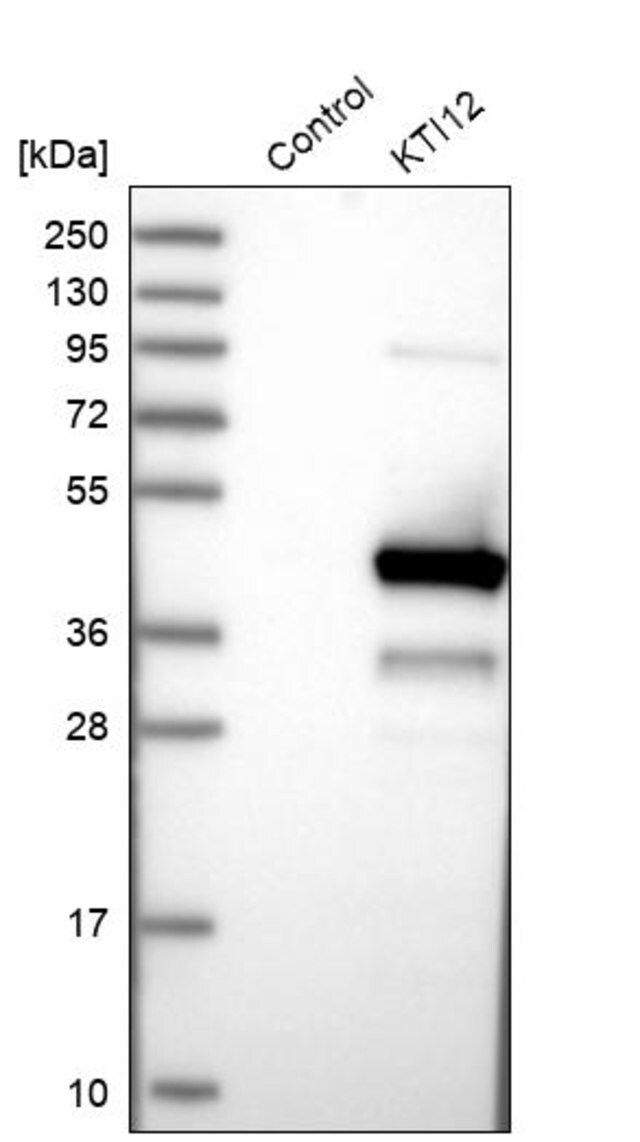 Anti-KTI12 antibody produced in rabbit