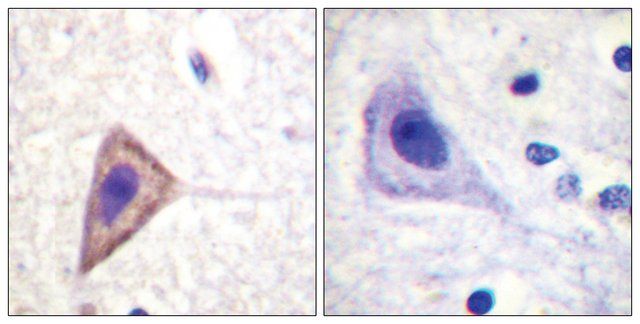 Anti-KV1.3 antibody produced in rabbit