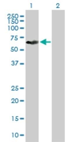 Anti-KRT6L antibody produced in mouse