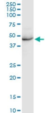 Anti-KRT35 antibody produced in rabbit