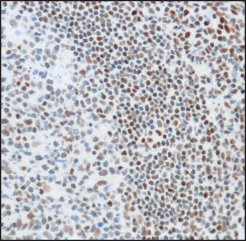 Anti-KU80 antibody, Rabbit monoclonal