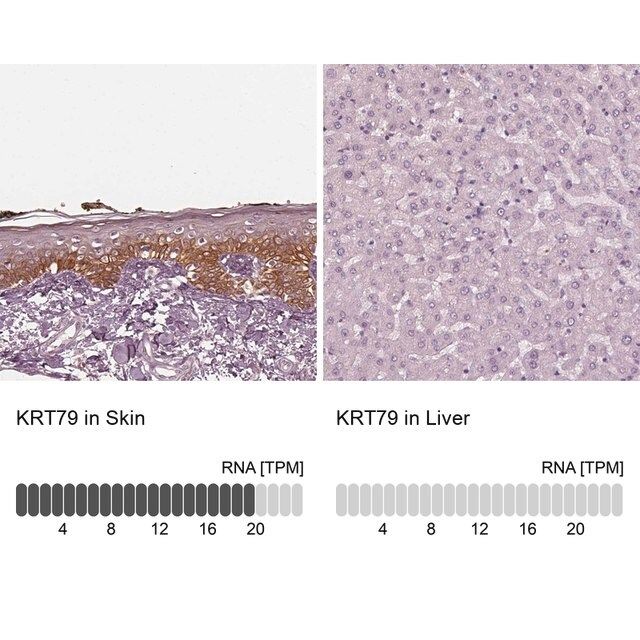 Anti-KRT79 antibody produced in rabbit