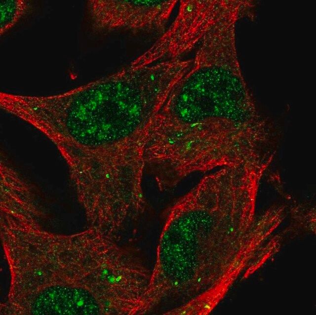 Anti-KTI12 antibody produced in rabbit