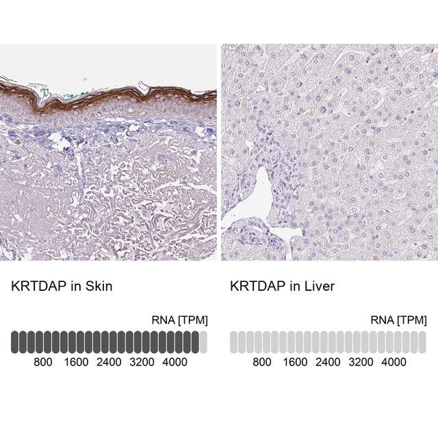 Anti-KRTDAP antibody produced in rabbit