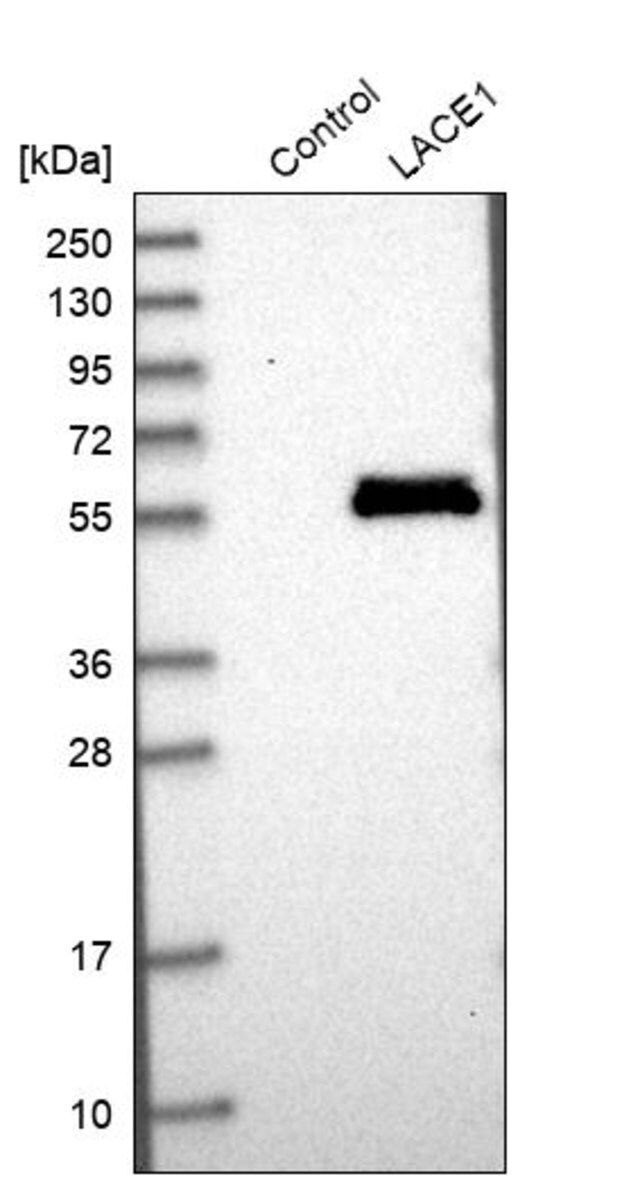 Anti-LACE1 antibody produced in rabbit